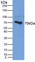 Polyclonal Antibody to Aggrecan (AGC)