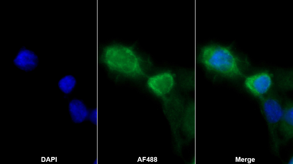 Polyclonal Antibody to Aggrecan (AGC)