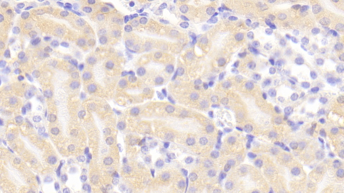 Polyclonal Antibody to Cholinergic Receptor, Nicotinic, Alpha 4 (CHRNa4)