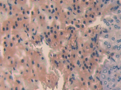 Polyclonal Antibody to Angiopoietin Like Protein 2 (ANGPTL2)