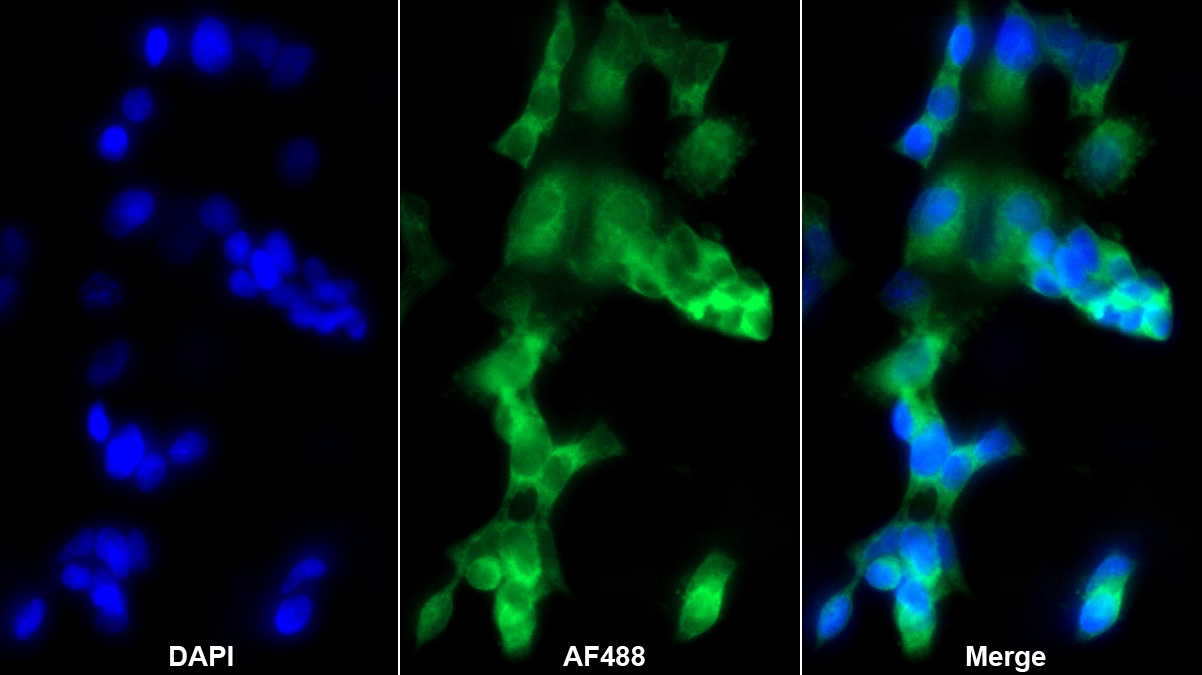 Polyclonal Antibody to Choline Acetyltransferase (ChAT)
