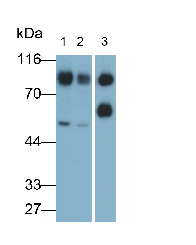 Polyclonal Antibody to Apotransferrin (apoTf)