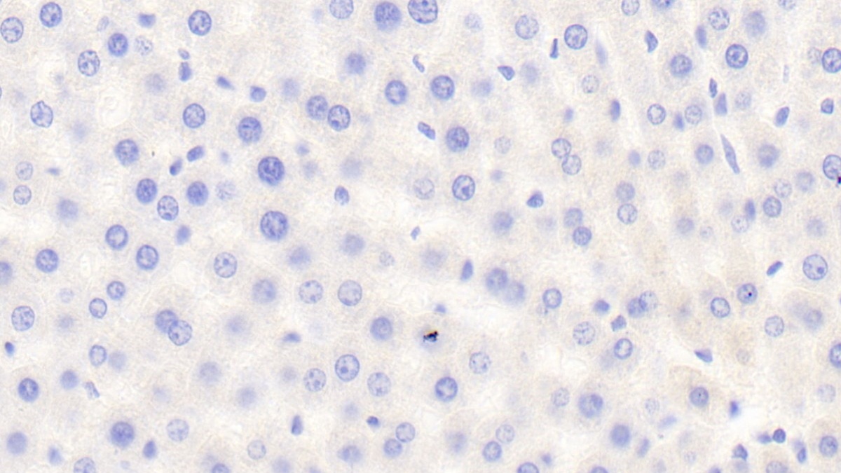 Polyclonal Antibody to Leucine Rich Alpha-2-Glycoprotein 1 (LRG1)