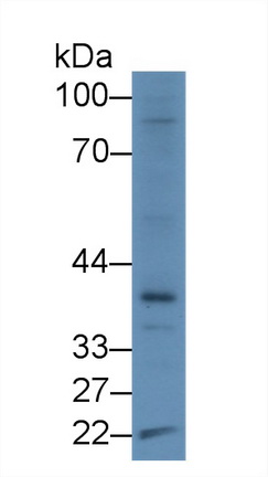 Polyclonal Antibody to Histone Acetyltransferase 1 (HAT1)