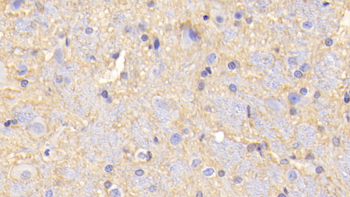 Polyclonal Antibody to Monoamine Oxidase A (MAOA)