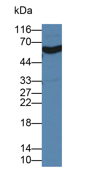 Polyclonal Antibody to Monoamine Oxidase A (MAOA)