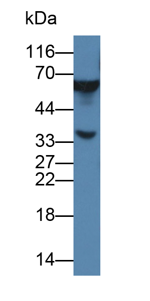 Polyclonal Antibody to Monoamine Oxidase A (MAOA)