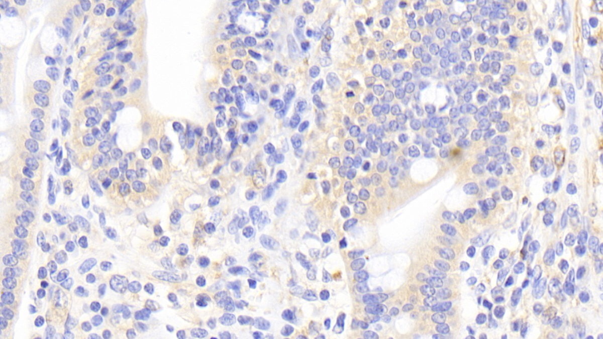 Polyclonal Antibody to Interleukin 17F (IL17F)