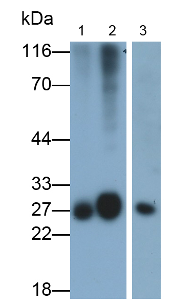 Polyclonal Antibody to Glutathione S Transferase Alpha 5 (GSTa5)