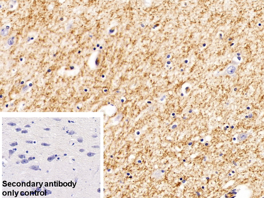 Polyclonal Antibody to Glutathione S Transferase Alpha 2 (GSTa2)