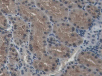 Polyclonal Antibody to Superoxide Dismutase 1 (SOD1)