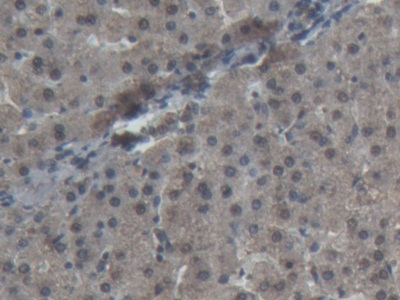Polyclonal Antibody to Superoxide Dismutase 1 (SOD1)