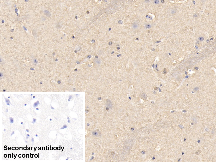 Polyclonal Antibody to Superoxide Dismutase 1 (SOD1)