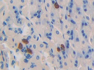 Polyclonal Antibody to Dynamin 1 (DNM1)