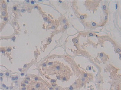 Polyclonal Antibody to Syndecan 1 (SDC1)