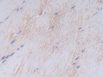 Polyclonal Antibody to Syndecan 1 (SDC1)