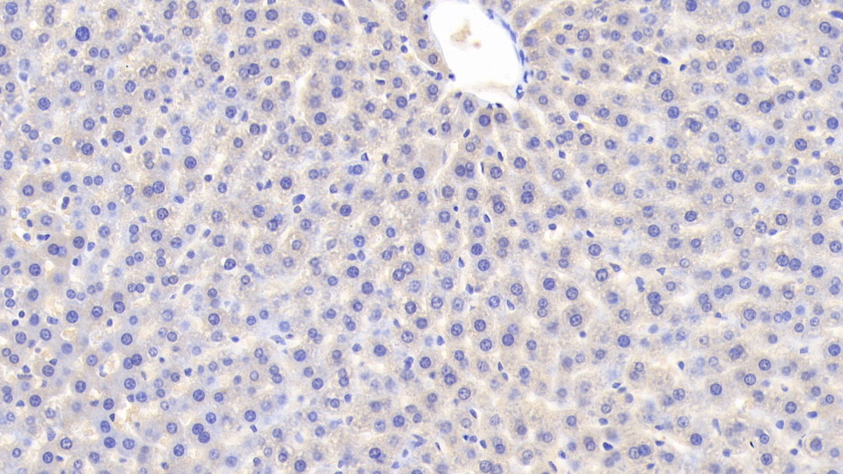 Polyclonal Antibody to Apolipoprotein D (APOD)