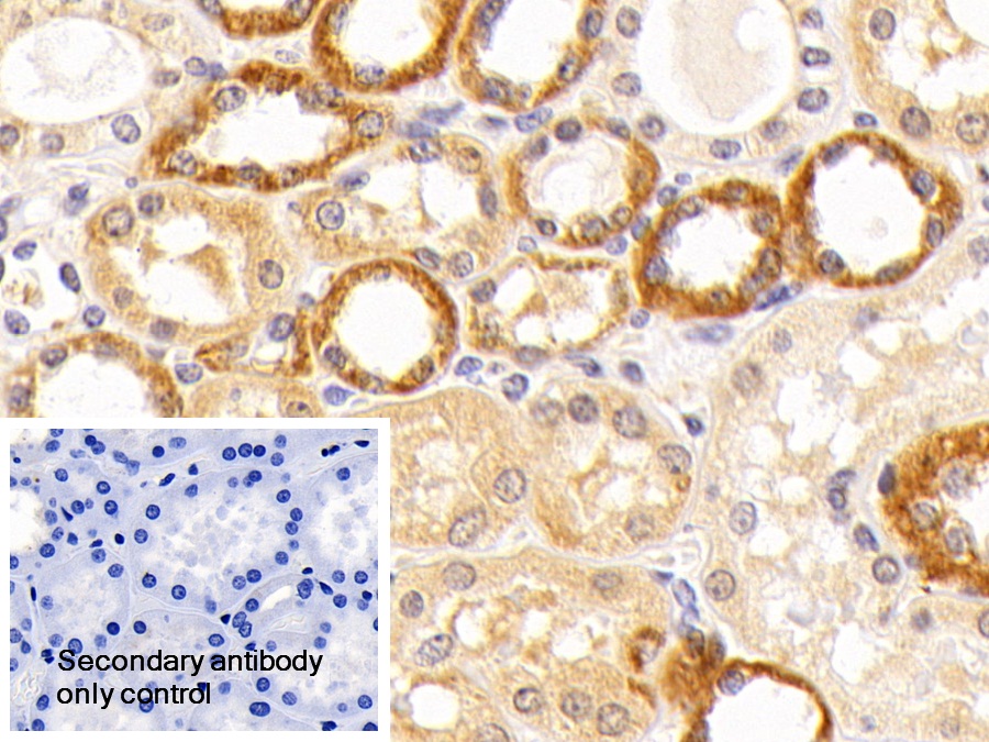 Polyclonal Antibody to Complement Component 5 (C5)