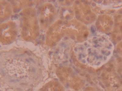 Polyclonal Antibody to Pigment Epithelium Derived Factor (PEDF)