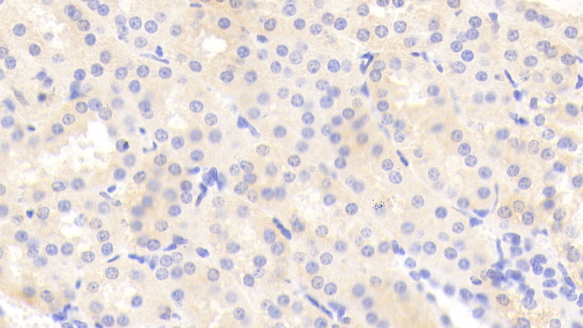 Polyclonal Antibody to Tenascin C (TNC)