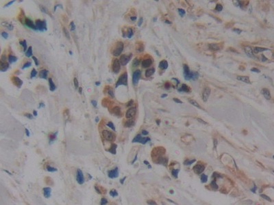 Polyclonal Antibody to Tau Protein (MAPT)