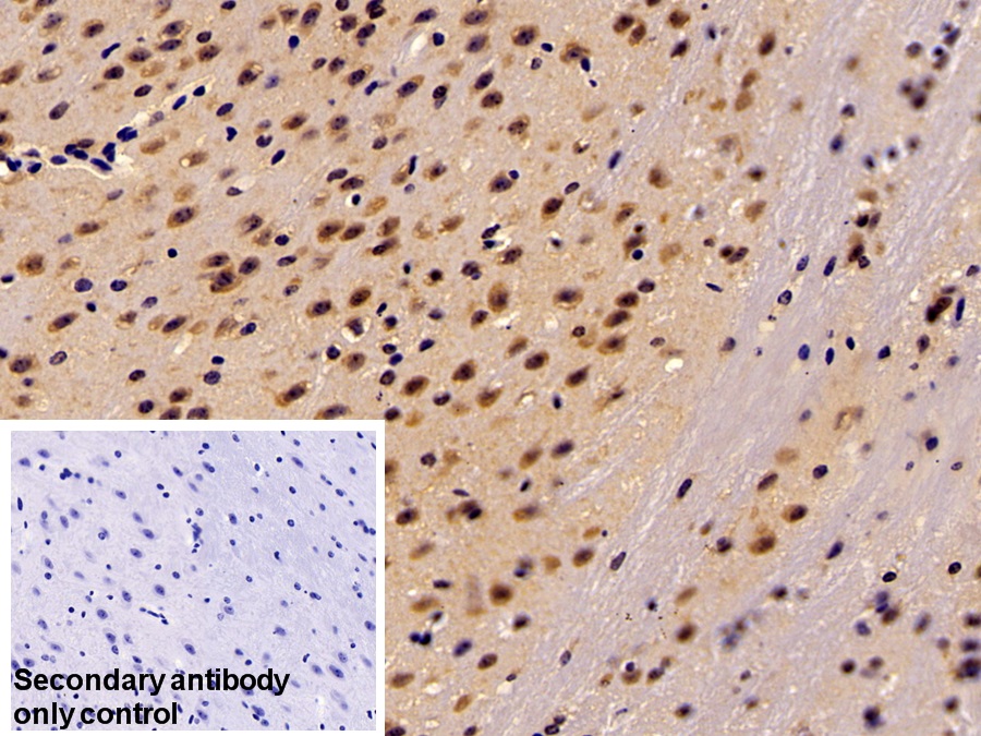 Polyclonal Antibody to Tau Protein (MAPT)