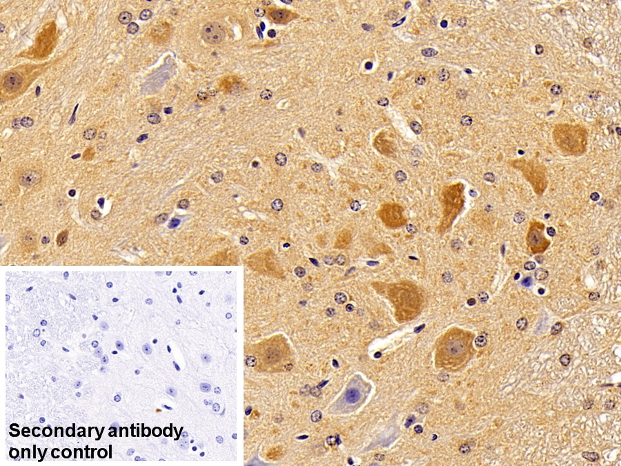 Polyclonal Antibody to Tau Protein (MAPT)