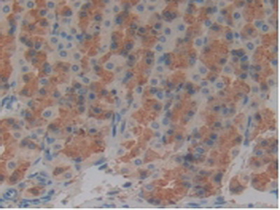 Polyclonal Antibody to Tau Protein (MAPT)