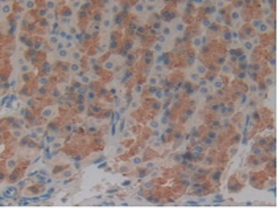 Polyclonal Antibody to Tau Protein (MAPT)