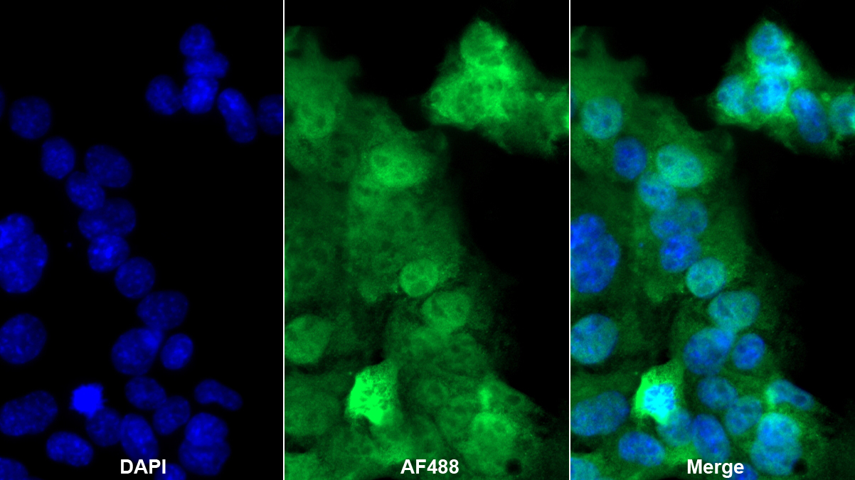 Polyclonal Antibody to Fatty Acid Binding Protein 5 (FABP5)