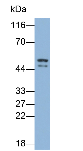 Polyclonal Antibody to Hemojuvelin (HJV)