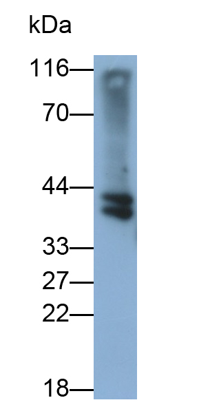 Polyclonal Antibody to Haptoglobin Related Protein (HPR)