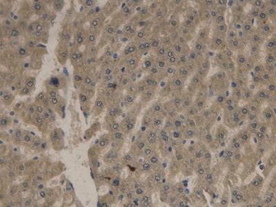 Polyclonal Antibody to Apolipoprotein B (APOB)