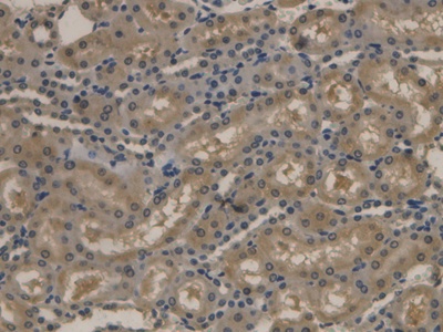 Polyclonal Antibody to Apolipoprotein B (APOB)