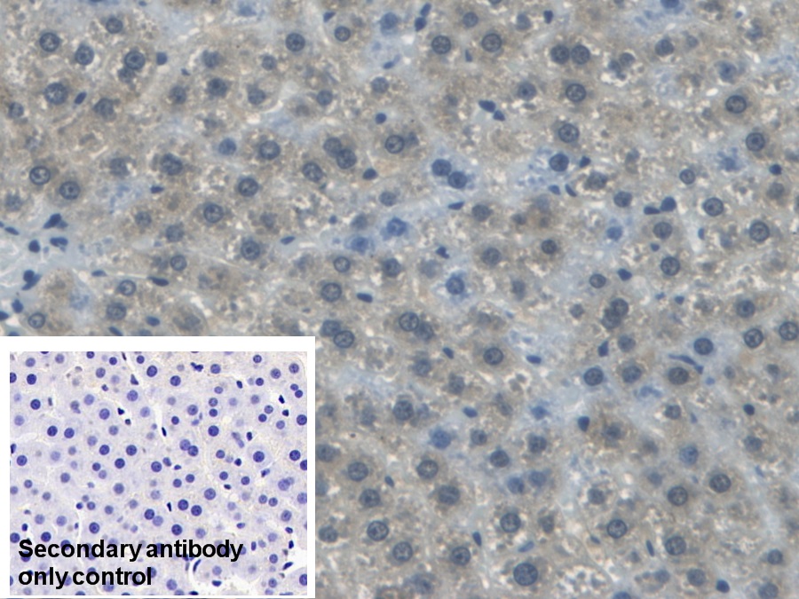 Polyclonal Antibody to Apolipoprotein B (APOB)