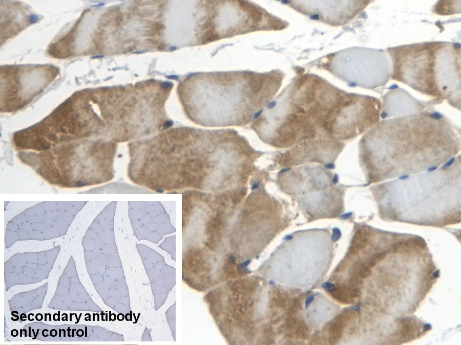 Polyclonal Antibody to Apolipoprotein B (APOB)