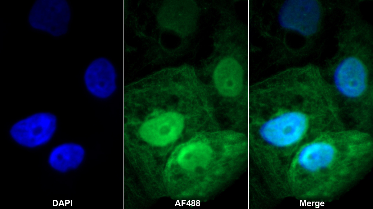 Polyclonal Antibody to S100 Calcium Binding Protein A2 (S100A2)