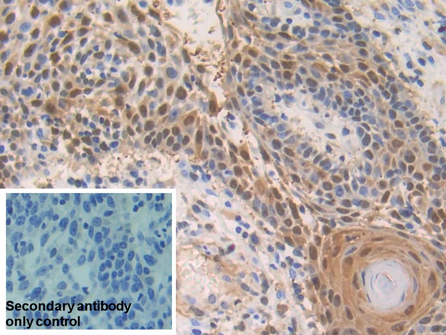 Polyclonal Antibody to S100 Calcium Binding Protein A2 (S100A2)