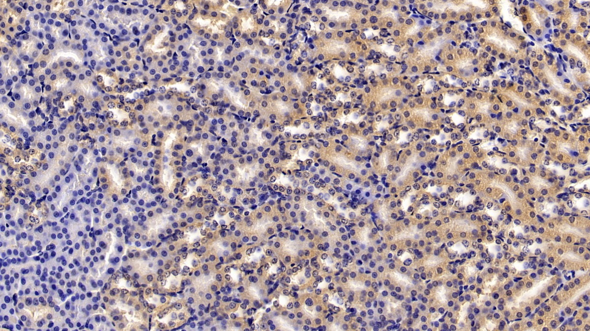 Polyclonal Antibody to Complement Factor B (CFB)