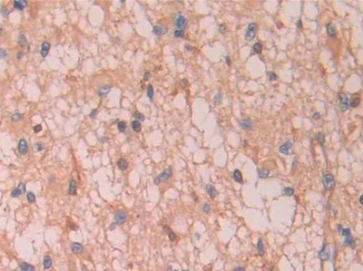 Polyclonal Antibody to Complement Factor B (CFB)