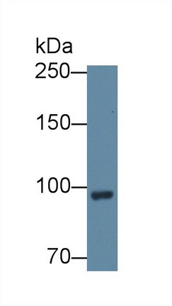 Polyclonal Antibody to Complement Factor B (CFB)