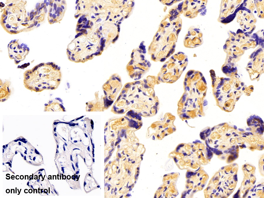 Polyclonal Antibody to Complement Factor B (CFB)