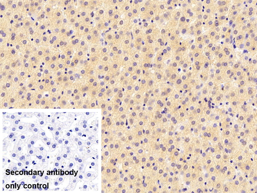 Polyclonal Antibody to Complement Factor B (CFB)