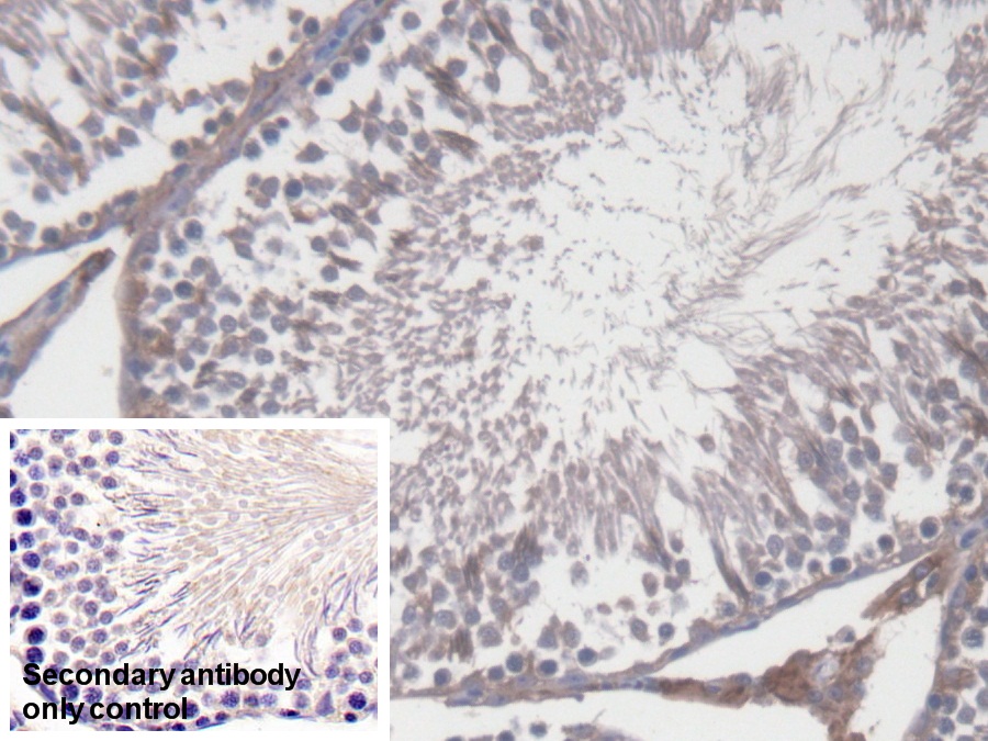 Polyclonal Antibody to Cytochrome P450 17A1 (CYP17A1)