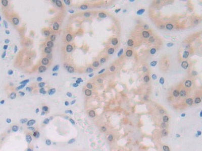 Polyclonal Antibody to Platelet Activating Factor Acetylhydrolase 2 (PAFAH2)