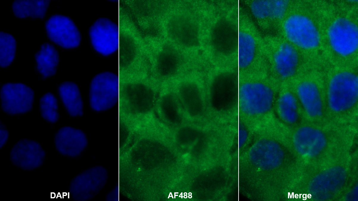 Polyclonal Antibody to Platelet Activating Factor Acetylhydrolase 2 (PAFAH2)