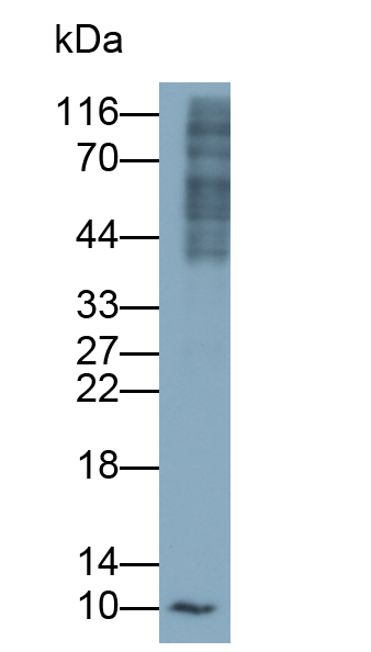 Polyclonal Antibody to S100 Calcium Binding Protein A4 (S100A4)