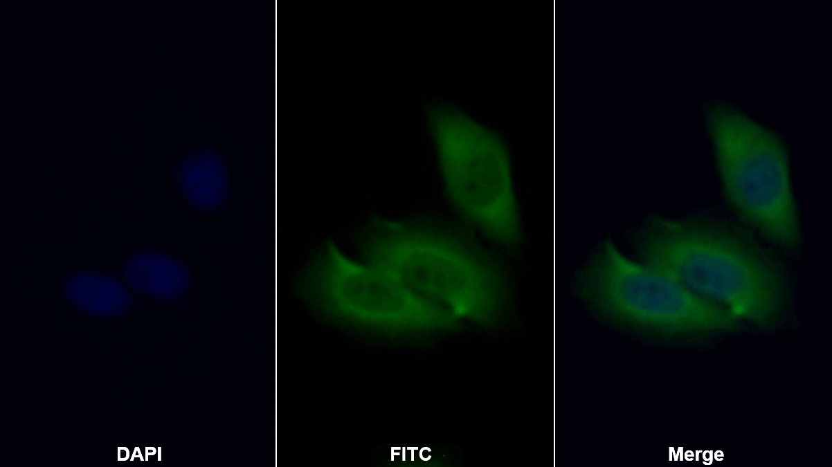 Polyclonal Antibody to Cytokeratin 8 (CK8)