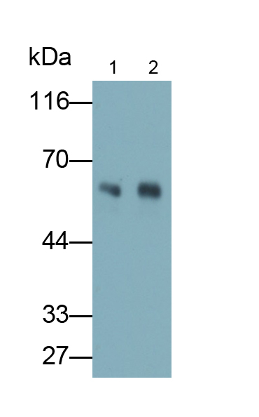 Polyclonal Antibody to Cytokeratin 8 (CK8)