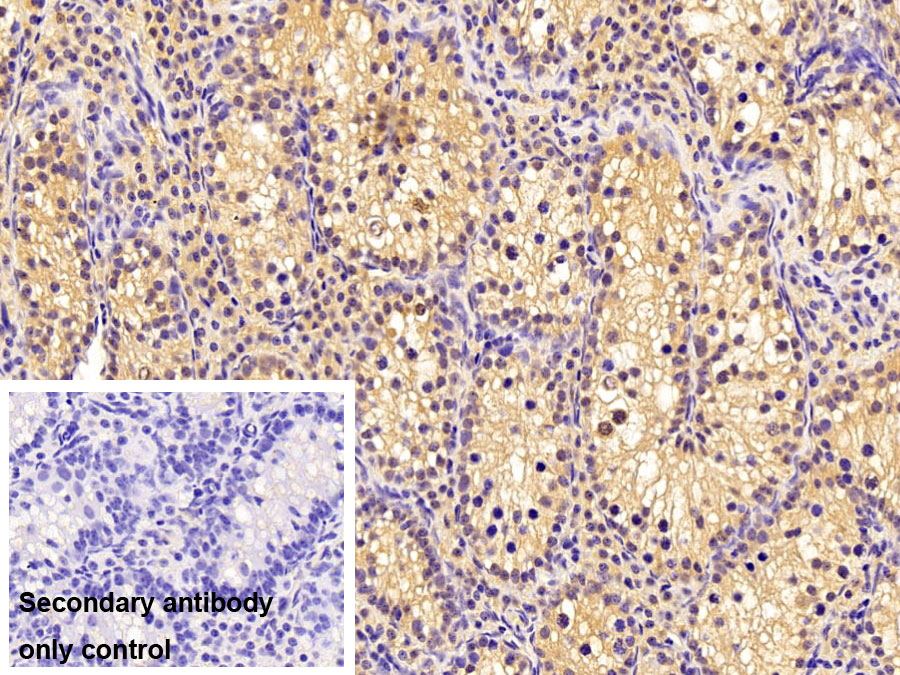 Polyclonal Antibody to O-6-Methylguanine DNA Methyltransferase (MGMT)